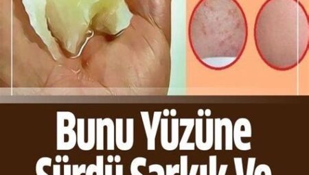 Yüzdeki Kızarıklıklar İçin Doğal Çözümler