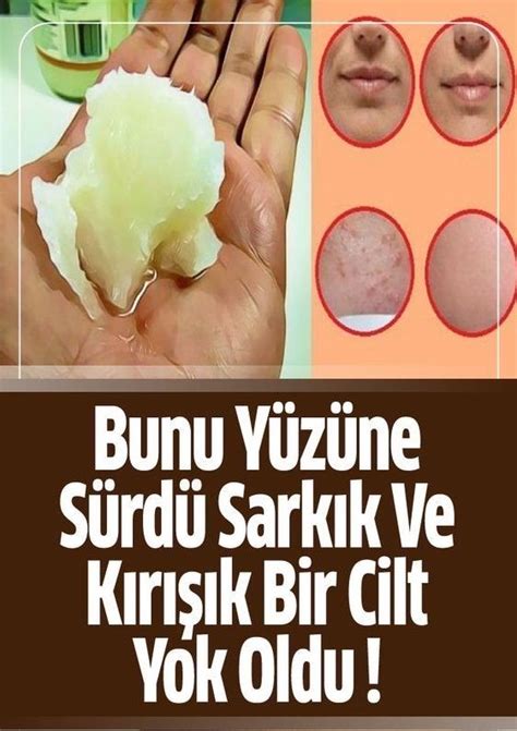 Yüzdeki Kızarıklıklar İçin Doğal Çözümler